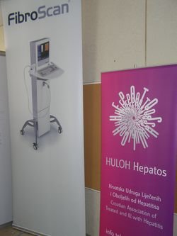 Fibroscan