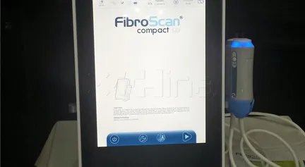Fibroscan 3