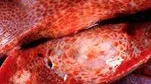 Fibroza