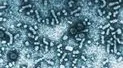 Hepatitis B R