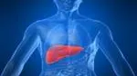 Nafld R
